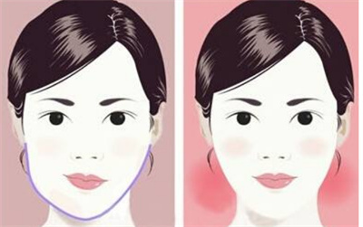 柱翰磨骨怎么样?柱翰医生坐诊医院实力如何?案例分享
