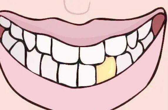 小苏打刷牙可以去烟渍吗？盘点几个牙齿美白的小tips!