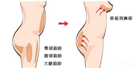 武汉协和郭科案例怎么样？大佬资料详情！手把手带你做攻略~