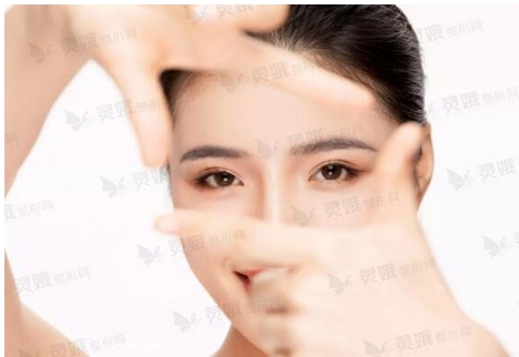 吴溯帆双眼皮案例如何？修复果如何_手术特点介绍~附案例分析！