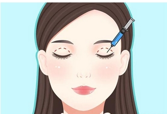 石杭燕割双眼皮案例如何?手术技术特点如何?美丽靓眼不是梦!