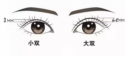 岑瑛双眼皮怎么样?医生团队技术实力怎么样?真实案例可以反映~