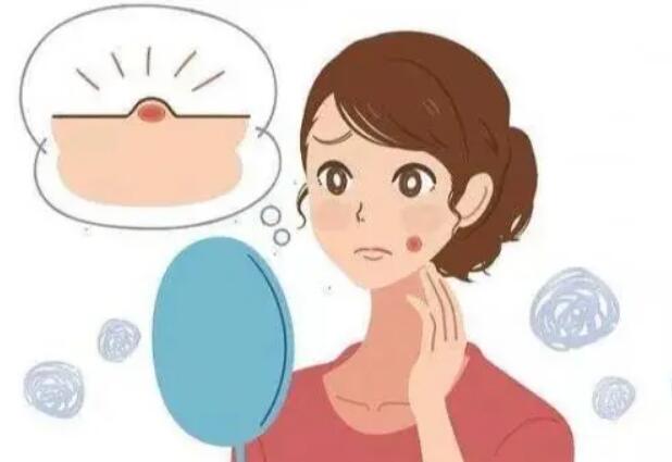 黑色痘印怎么消除？调节方法有哪些？祛痘指南~