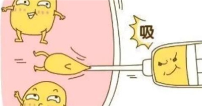 上海首尔丽格崔荣达医生怎么样?吸脂瘦身案例分享,口碑评价不错!