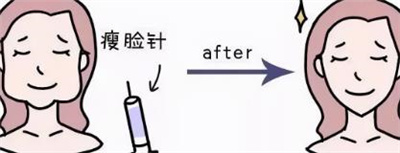 南京美贝尔美容医院打注射瘦脸多少钱 ?2023年实力口碑靠前!