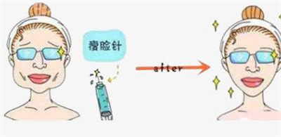 南京美贝尔美容医院打注射瘦脸多少钱 ?2023年实力口碑靠前!