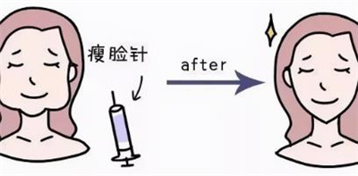 姜陶然瘦脸案例分享,术后的形象真的惊呆了,轮廓好美!