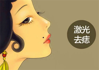 激光点痣1到7天图分享~真实案例分享,讲解注意事项