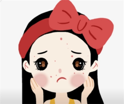 激光祛痘案例~ 调节后皮肤洁白无瑕-恢复奶油肌