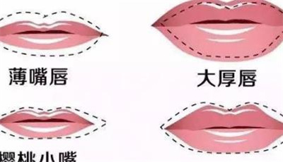 玻尿酸丰唇需要多少钱？能维持多久的时间？