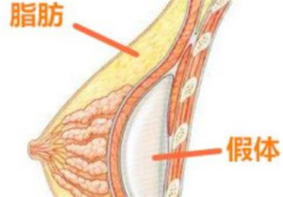 西京医院自体脂肪填充隆胸丰胸多少钱?真实案例分享!