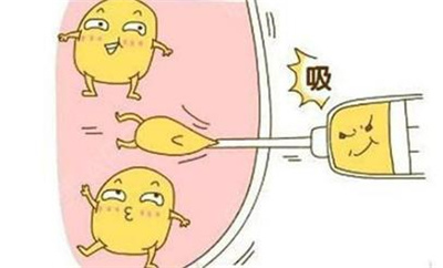 什么样的小腿适合吸脂手术，小腿吸脂手术效果怎么样？