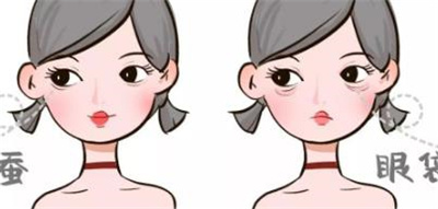 去眼袋整容医院挂什么科,去眼袋案例详情!