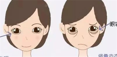 八大处美容医院去眼袋怎么样?详细介绍,戳进来了解!