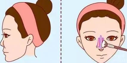 鼻头鼻翼缩小术价格贵吗?价格的高低和哪些因素有关呢?戳进来看详情