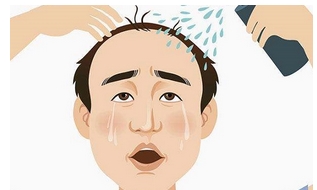 济南中心医院秃顶植发需要多少钱?怎样选择靠谱的植发医生!果怎么样?