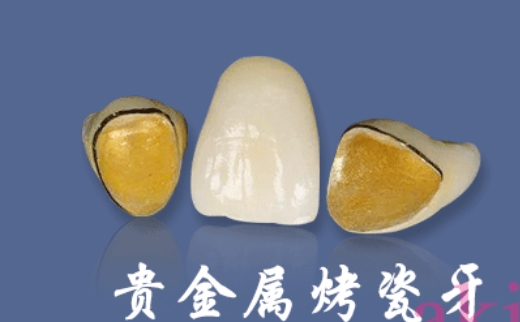 珠海人民医院半贵金属烤瓷牙价格如何?好的口腔医院收费标准镶牙拔牙都有!
