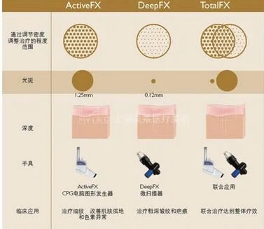 新桥医院整形美容科点阵激光如何?专业医生名单揭晓!美肤体验分享~