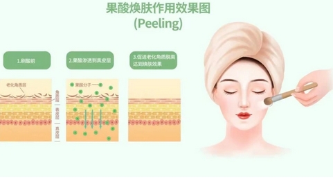 芯丝翠果酸换肤是什么?需要多久做一次?详细护理及步骤分享!