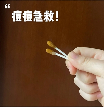 碘伏可以涂在痘痘上吗?还有哪些方法可以祛除痘痘呢?