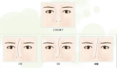 南大一附医院美容科歪鼻整形的价格如何?医生介绍!隆鼻体验怎么样?