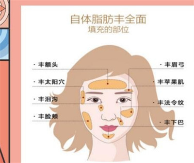 脂肪填充多久恢复好？自体脂肪填充护理小方法分享