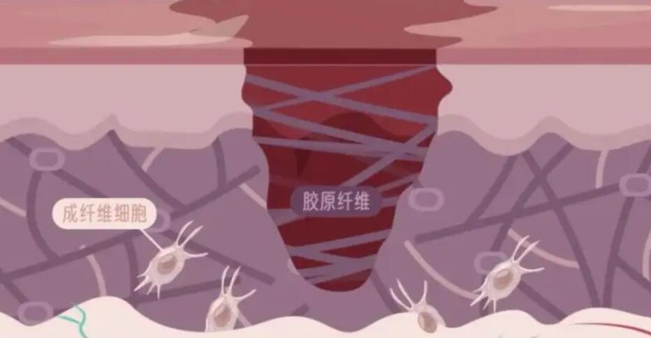臧梦青疤痕修复案例图展示!医生简介及网友手术日记分享!