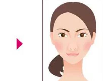 激光溶脂瘦脸会反弹吗?激光溶脂瘦脸后如何护理?