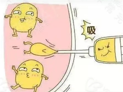 小腿可以做吸脂手术吗?小腿吸脂手术多久可以恢复?