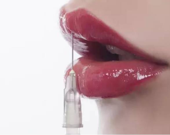 玻尿酸丰唇整形多少钱？价格是如何确定的？附23年价格表