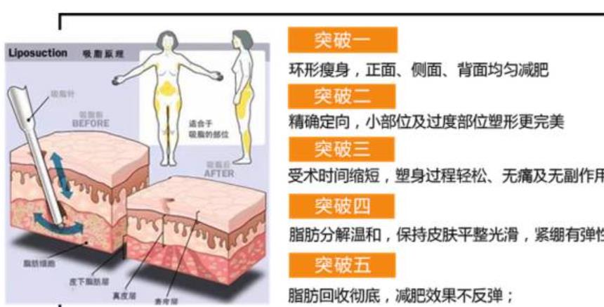 产后减肥人气方法是什么?水动力吸脂的步骤介绍!