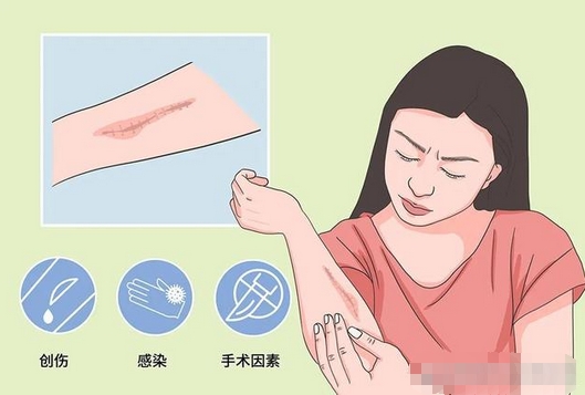 谭军医生调节疤痕好吗?让疤痕消除的“魔法师”~看看案例分享如何?