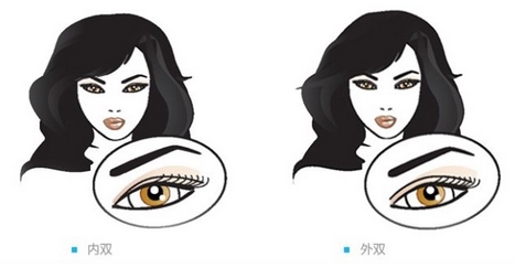 协和医院朱琳双眼皮案例如何?医生怎么样?简介公开,双眼皮案例测评!