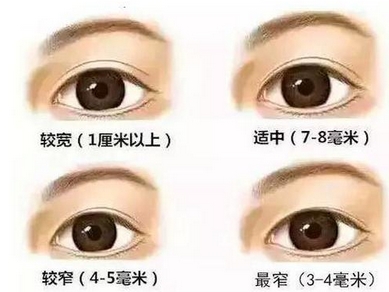 协和医院朱琳双眼皮案例如何?医生怎么样?简介公开,双眼皮案例测评!