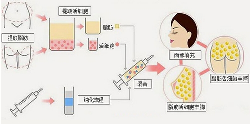 上海华美医疗美容医院怎么样?虽不是公立医院但很正规哦!医生名单_案例分享~