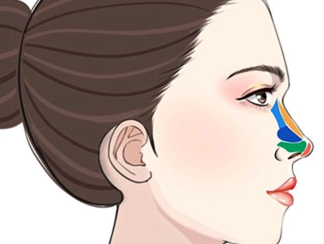 鼻炎求美可以隆鼻吗？这几点你一定要注意了！