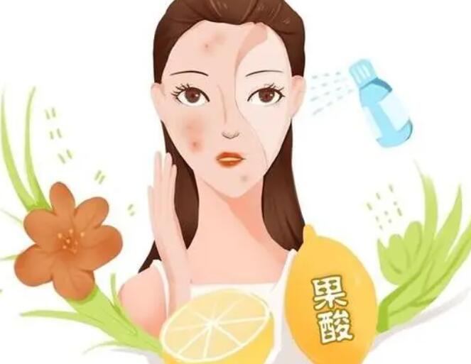 刷酸需要注意什么?刷酸注意事项盘点!看完再决定~