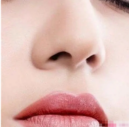 鼻翼缩小手术是永久的吗？只做鼻翼缩小有果吗？让我们的颜值无限上分~