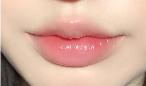 上唇M下唇花瓣怎么样?费用需要花费多少呢?这种唇形超诱人!