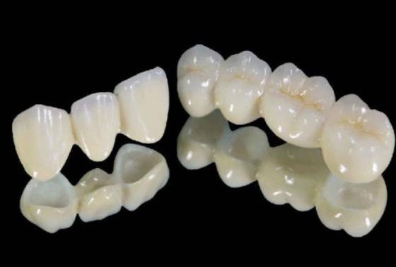 长春烤瓷牙多少钱？烤瓷牙一般可以使用多少年？优缺点介绍
