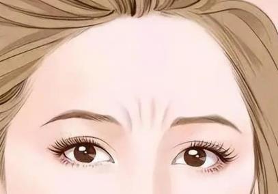 去除抬头纹的价格怎么样?有哪些影响因素,来了解?