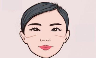 颧骨高怎么办?有哪些方式可以改良,戳进来吧