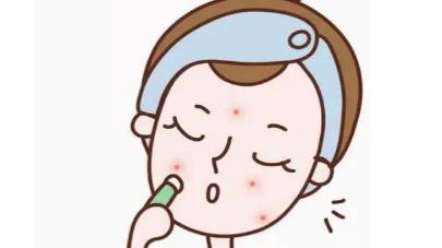 像素激光去痘坑效果怎么样?哪些值得了解,戳进来吧!