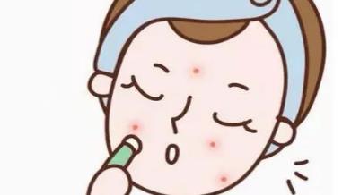怎么去除痘坑?有哪些方式?以及术后如何护理?