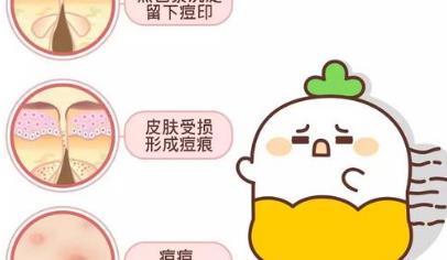怎么去除痘坑?有哪些方式?以及术后如何护理?