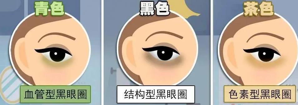 如何去掉黑眼圈？大众认可的几个小技巧汇总！都挺适用~