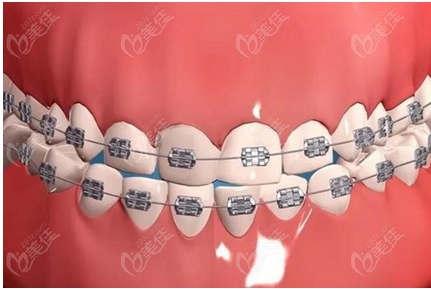 广州曙光口腔医院口碑怎么样?大家的评价及看牙收费标准贵吗?
