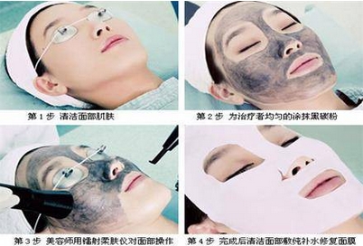 黑脸娃娃改良色素沉著吗？具体优势有哪些？医美干货小课堂，带你了解ta！