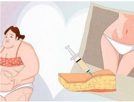 韩国明星怎么瘦腿?女团瘦腿方法有哪些?饮食、运动缺一不可?