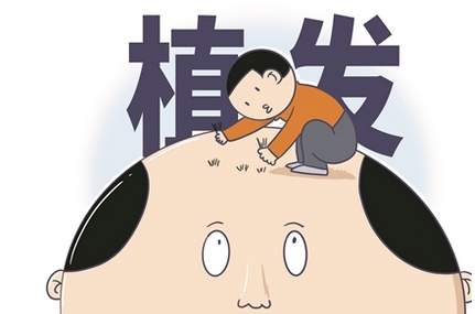 广州曙光植发怎么样？植发是否正规揭秘！医院地址及医生介绍~